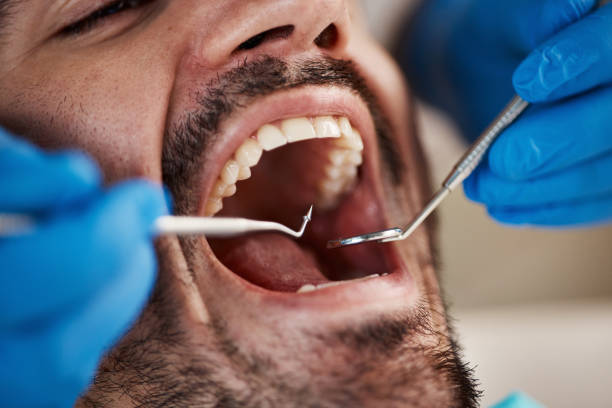 Best Emergency Dentist for Knocked-Out Tooth in Orange Lake, NY
