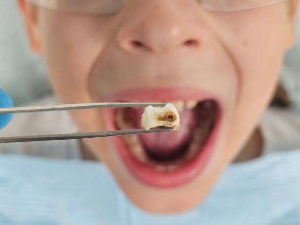 Best Emergency Dentist for Knocked-Out Tooth in Orange Lake, NY